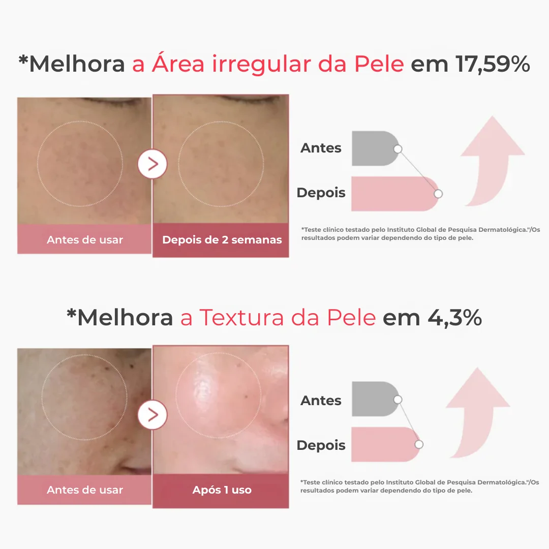 Soro Shot PDRN 2000 Collágeno Rosa – Glow e Elasticidade