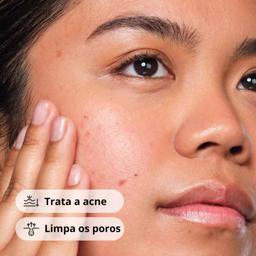 The Ordinary Salicylic Acid 2% Sérum Antiacne